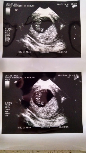 ultrasound 8-25.jpg